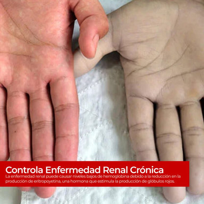 Tira Reactiva para Hemoglobina para Equipo 4 en 1 REDDYZ